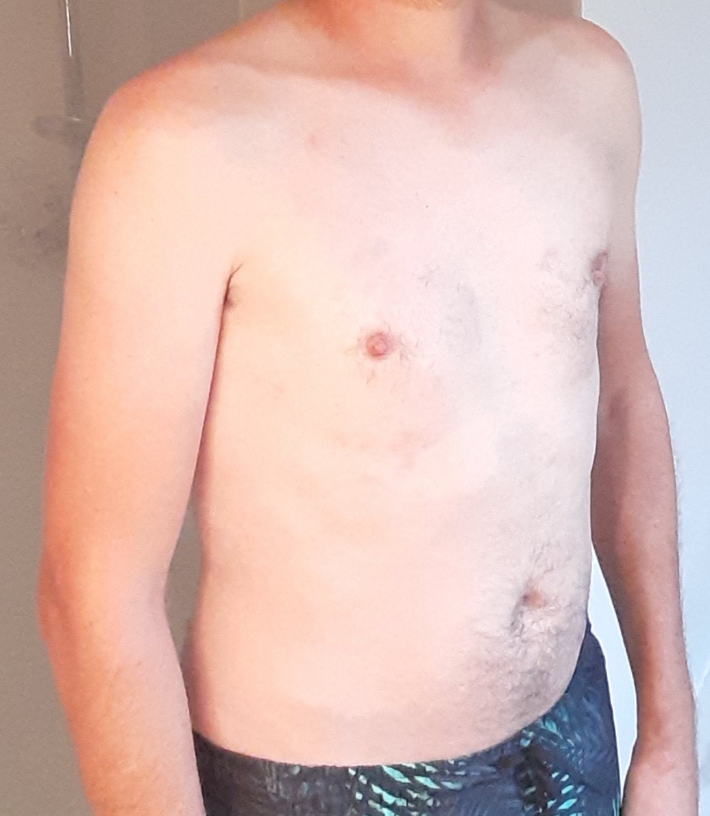 Fritz - Rimou - Ille-et-Vilaine | Rencontre gay